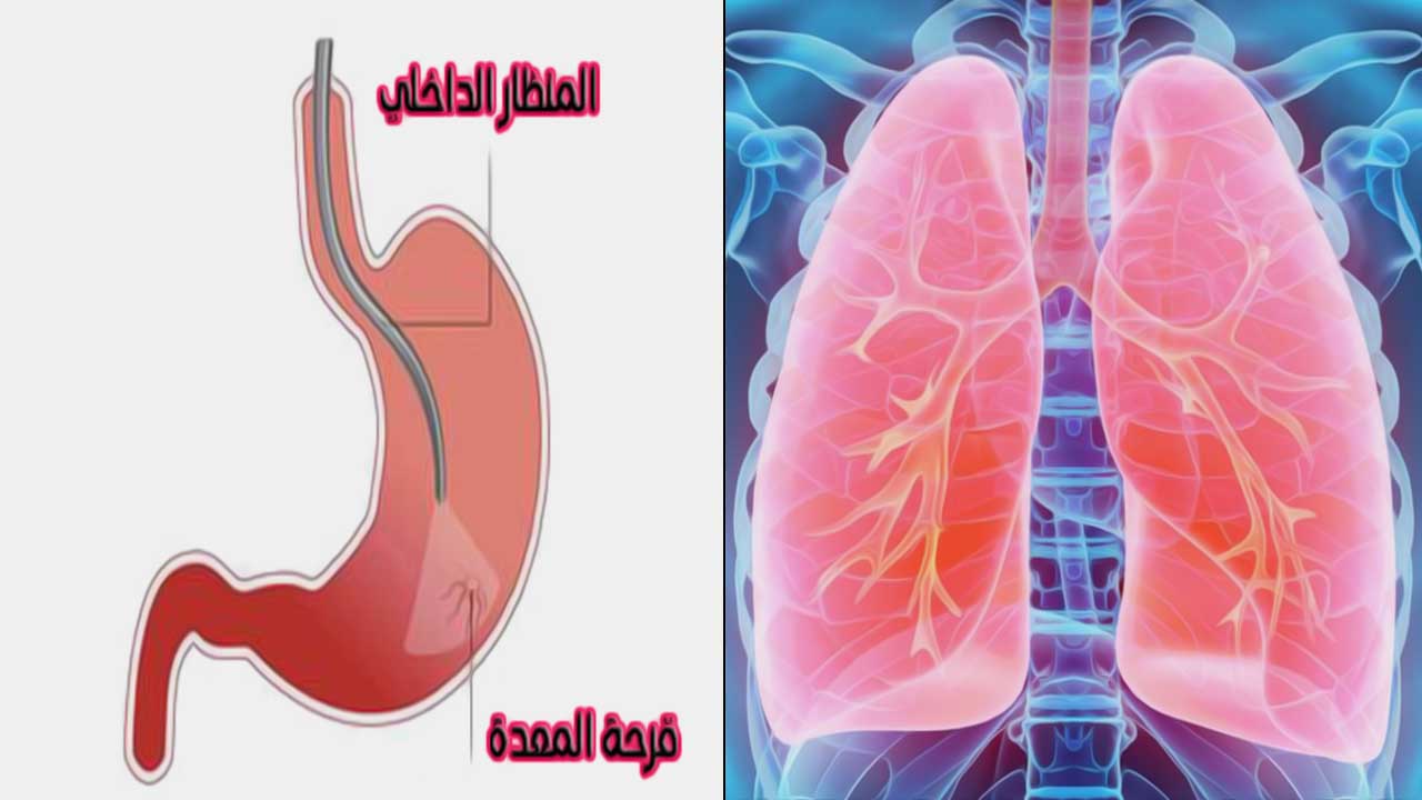 استعمال اقراص ميوكوستا