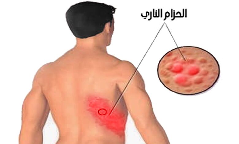 ماهو الحزام الناري