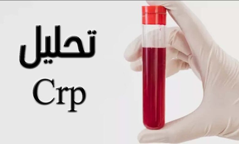 تحليل crp مرتفع